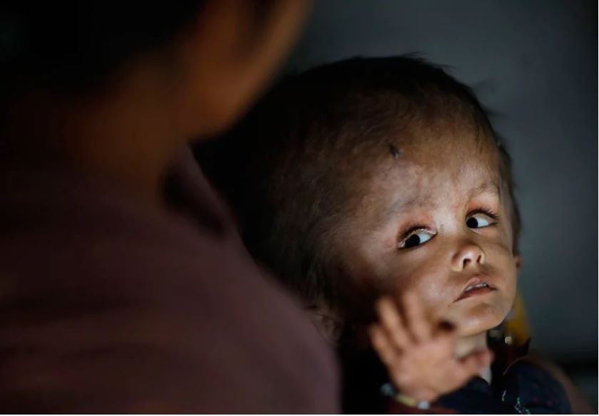 आमालाई मृत्युअघि बाई गरेको फोटो उत्कृष्ट