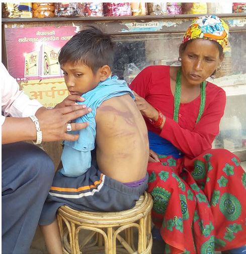 दलितले पाउँदैनन् जन्ती र मलामी