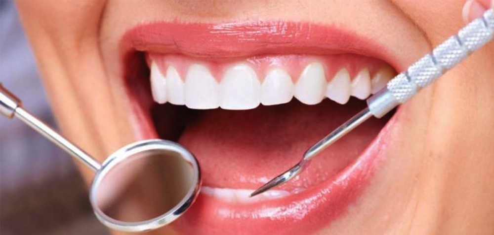 असाध्यै दुख्छ दाँत ? यी ८ प्राकृतिक तरिकाले दिनेछ आराम