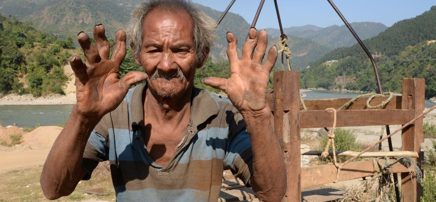 तुइन तान्दै बांगिए औँला , तर अझै उस्तै तुइन