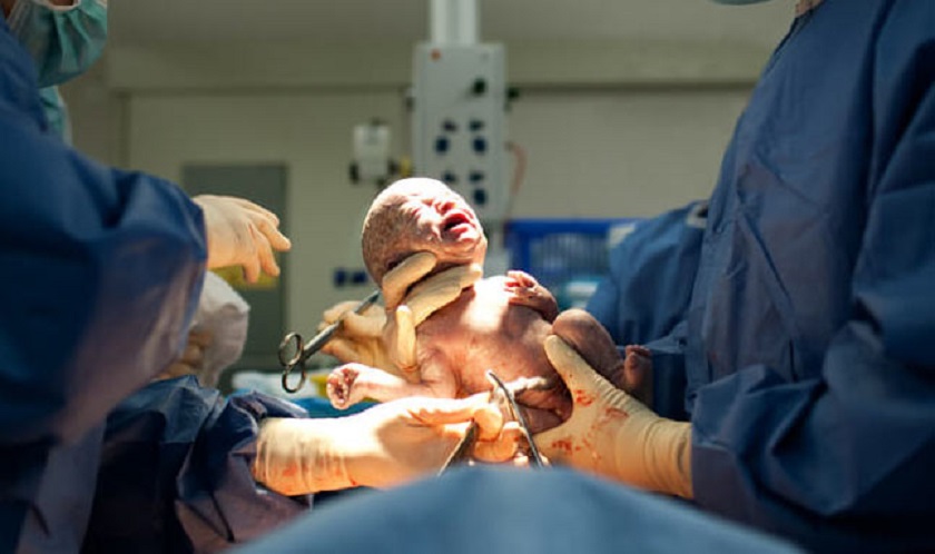 भरतपुर अस्पतालमा सुत्केरी हुन आउने गर्भवतीमध्ये ४० प्रतिशतको शल्यक्रिया