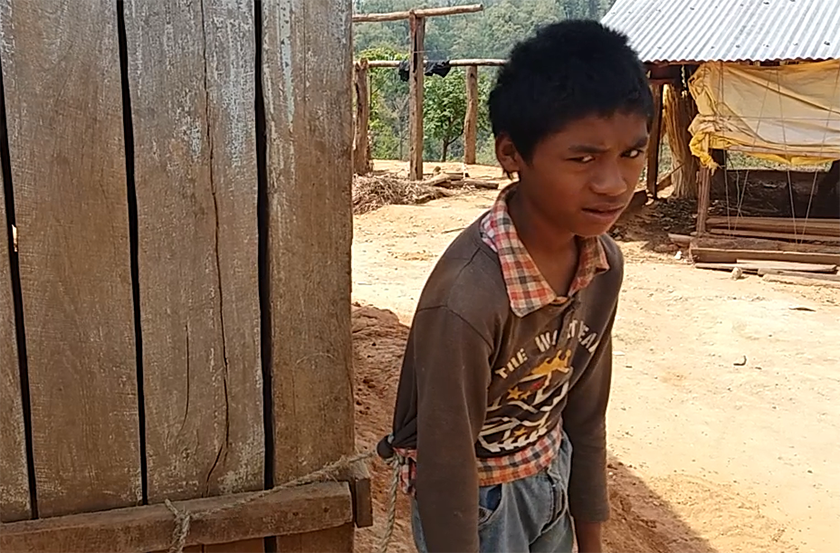 १४ वर्ष देखि दाम्लोमा बाधिदै बालक: गरीबिका कारण उपचारमा समस्या
