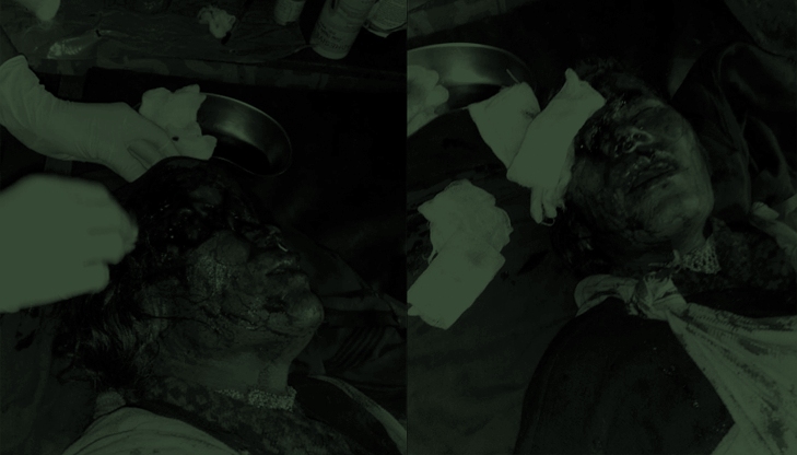 भालुको आक्रमणबाट दुई जना घाइते