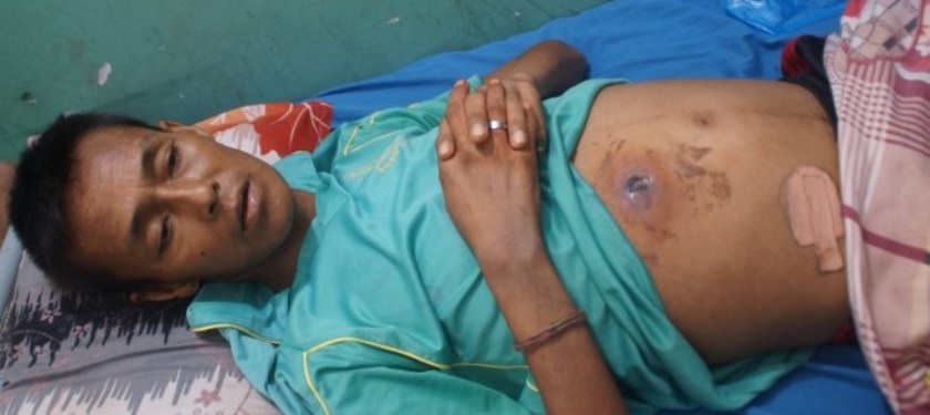 झाँक्रीले पेटमा प्वाल पारेर गलत उपचारपछि मृत्यु भएपनि प्रहरीले उजुरी लिन मानेन