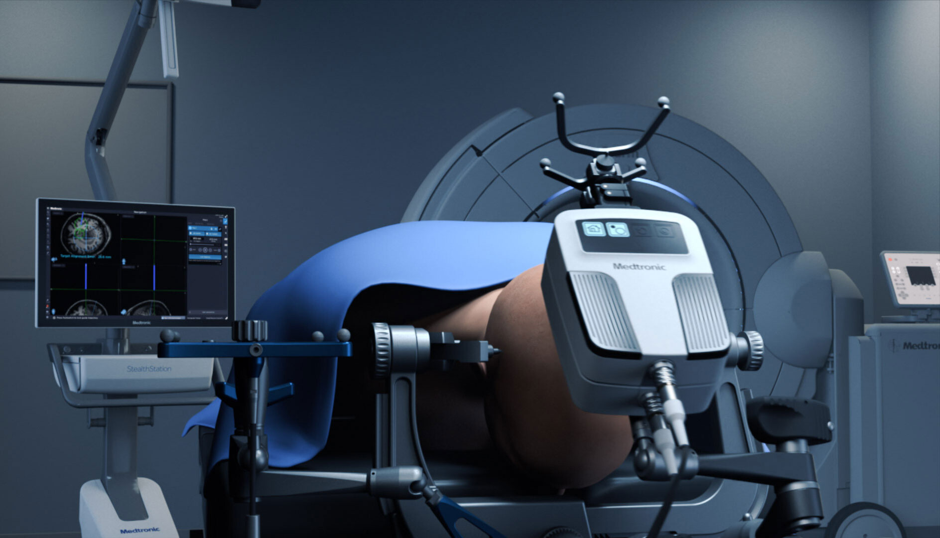 काठमाडौं मेडिकल कलेजले नेपालमै पहिलो पटक रोबोटबाट सर्जरी सुरु गर्दै